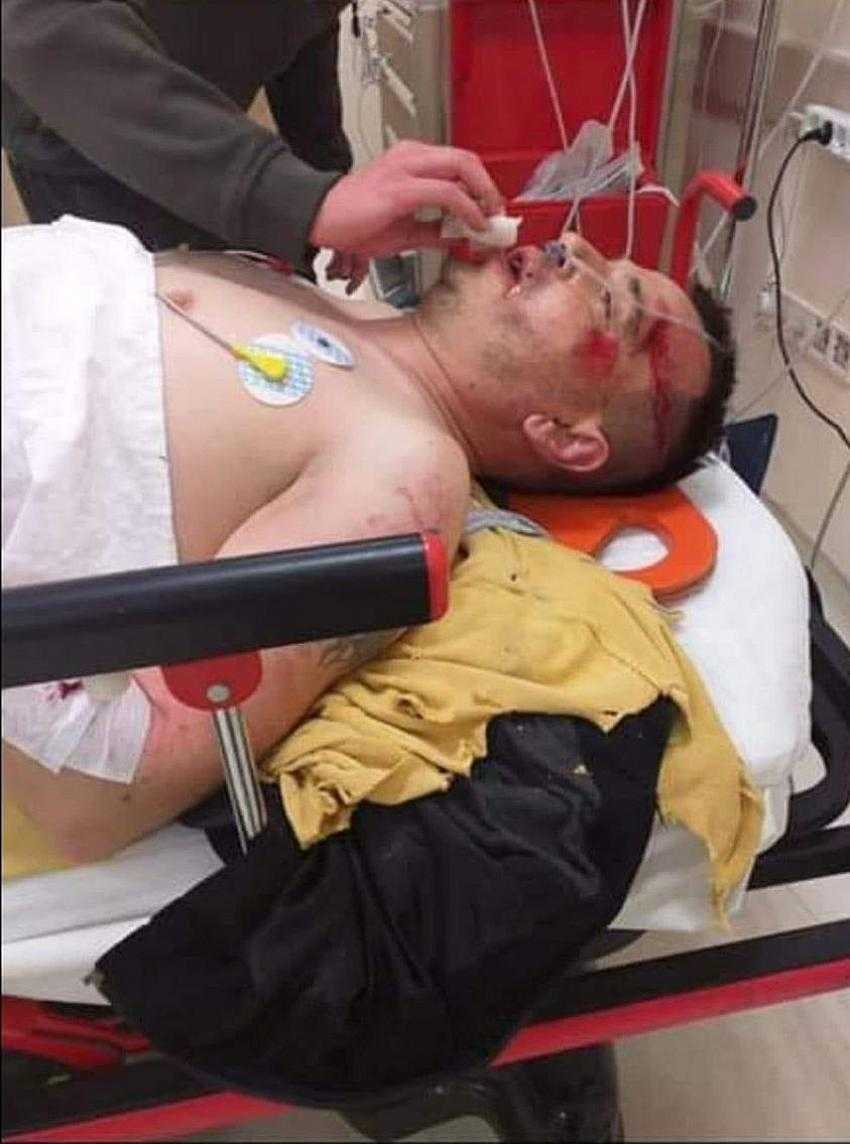 Berkin Can Yoğun Bakımda